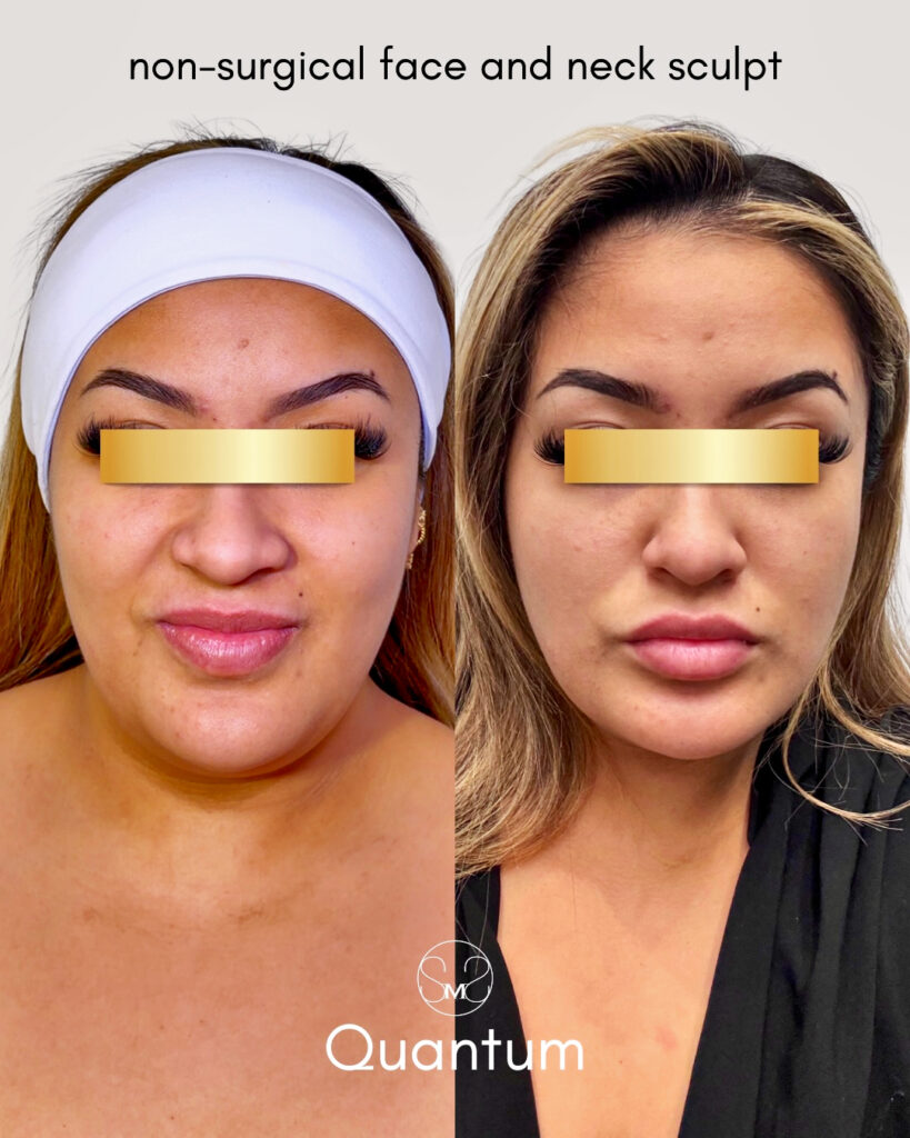 processed-5701BB60-13C1-4FE5-A5C1-F705C951B732