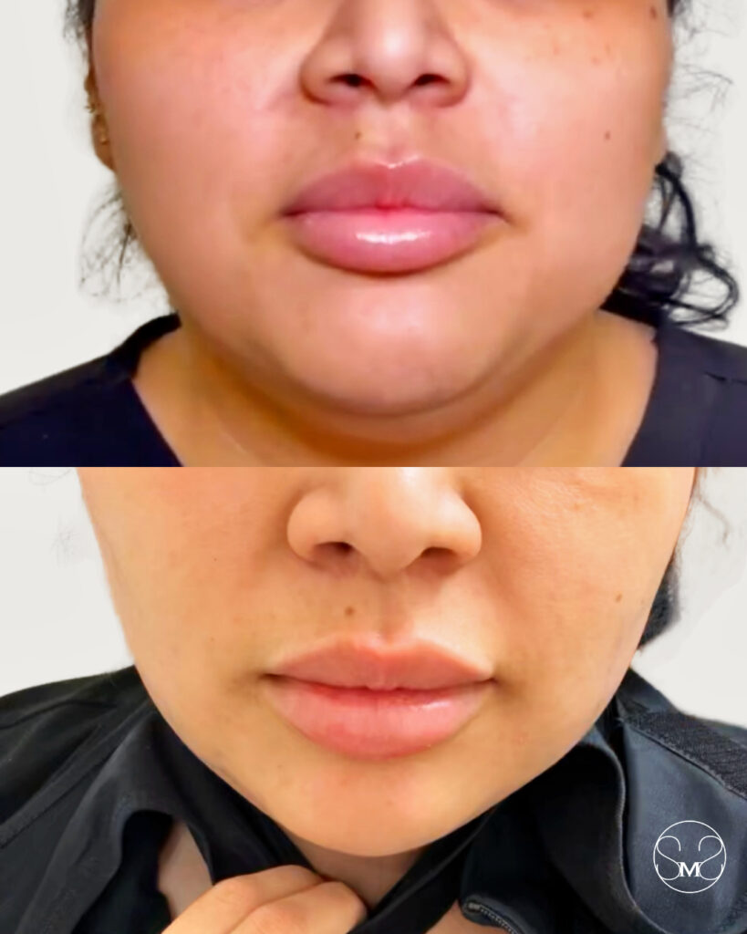 processed-6A146255-709F-4DC8-B6A2-15A9D91A8F6B