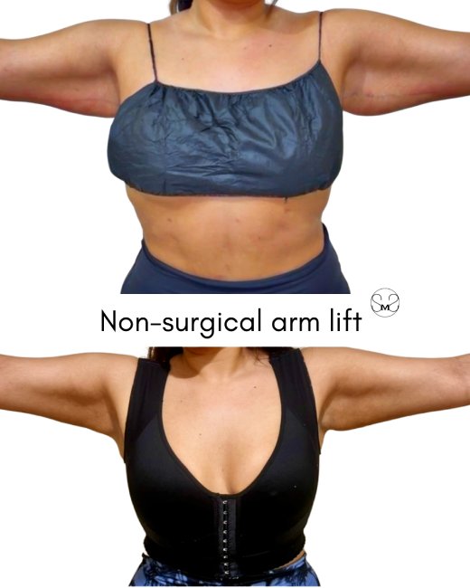 processed-E0018F27-79CC-473F-97F6-7EC99DBEDB39